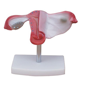 Natural Uterus Model